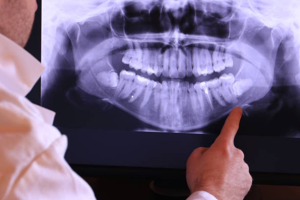 Best Emergency Dental Care for Abscessed Tooth in Mount Morris, IL