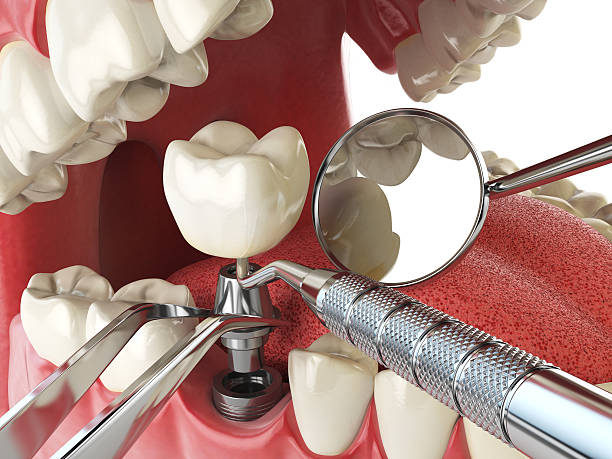 Best Emergency Dentist for Knocked-Out Tooth in Mount Morris, IL